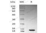 Recombinant Human LAMTOR3/MP1 Protein (His Tag)