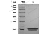 Recombinant Human MIA Protein (His Tag)