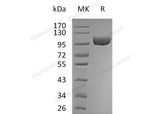 Recombinant Human VAP-1/AOC3 Protein (His Tag) 