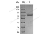 Recombinant Human Mesothelin/MSLN Protein (aa 296-598, Fc Tag)