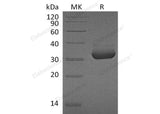 Recombinant Human Mesothelin/MSLN Protein (aa 37-286, His Tag)