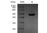 Recombinant Human MAP1D Protein (His Tag)