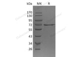 Recombinant Human METAP2 Protein (His Tag) 