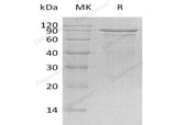 Recombinant Human MECP2 Protein (His Tag)