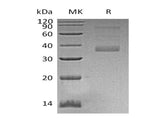 Recombinant Human MFAP4 Protein (His Tag)