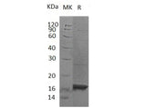 Recombinant Human MAP1LC3A Protein (His Tag)