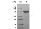 Recombinant Human Tau-F Protein