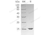 Recombinant Human Mitochondrial Fission 1 Protein/FIS1 Protein (His Tag)