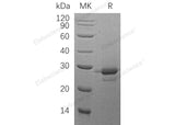 Recombinant Human MOB1A Protein (His Tag)