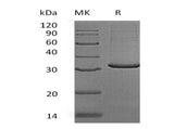 Recombinant Human MOB4/MOBKL3 Protein (His Tag)