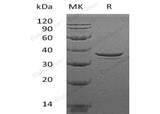 Recombinant Human MORF4L2/MRGX Protein (His Tag)