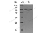 Recombinant Human SMAD3 Protein (His & Flag Tag) 