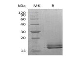 Recombinant Human Motilin/MLN Protein (His Tag)