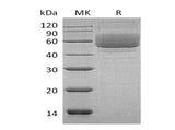 Recombinant Human Mucin-1/MUC-1 Protein (Fc Tag) 