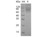 Recombinant Human Mucin-15/MUC15 Protein (His Tag)