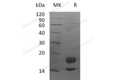 Recombinant Human Myelin Protein P0/MPZ Protein (His Tag)