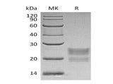 Recombinant Human MPZL1 Protein (His Tag)