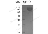 Recombinant Human MAG/Siglec-4a Protein (His Tag)