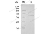 Recombinant Human Myozenin-2/MYOZ2 Protein (His Tag)