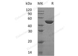 Recombinant Human GALK2 Protein (His Tag)