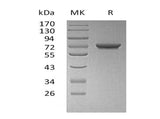 Recombinant Human GALNT7 Protein (His Tag)