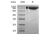 Recombinant Human GNS Protein (His Tag)