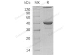 Recombinant Human NANS/SAS Protein (His Tag)