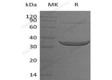 Recombinant Human ACY3 Protein (His Tag)