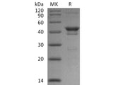 Recombinant Human NAD Kinase/NADK Protein (His Tag)