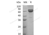 Recombinant Human NCR1 Protein (Fc Tag)