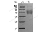 Recombinant Human 2B4/CD244 Protein (His Tag)