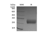 Recombinant Human KLRD1/CD94 Protein (His Tag) 