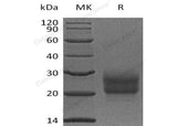 Recombinant Human NCR3/NKp30 Protein (His Tag)