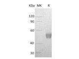 Recombinant Human NCR3/NKp30 Protein (Fc Tag)