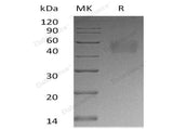 Recombinant Human Nectin-3/PVRL3 Protein (His Tag)