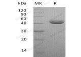 Recombinant Human Nectin-4/NECTIN4 Protein (His Tag)(Active)