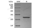 Recombinant Human NEDD8 Protein (His Tag, SUMO Tag)