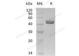 Recombinant Human Netrin-G1/NTNG1 Protein (His Tag)