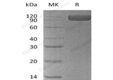 Recombinant Human NCAM1 Protein (His Tag)