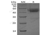 Recombinant Human Neurexophilin-1/NXPH1 Protein (His Tag)