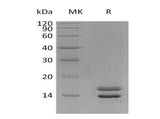 Recombinant Human NRN1L Protein (His Tag)