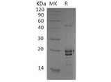 Recombinant Human Neurocalcin-δ/NCALD Protein (His Tag)