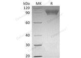 Recombinant Human NLGN4X Protein (His Tag)