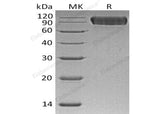 Recombinant Human Neuroligin 1/NLGN1 Protein (His Tag)