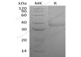 Recombinant Human CHRNB3 Protein (His Tag)