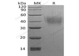 Recombinant Human Neuroplastin/NPTN Protein (His Tag)