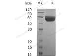 Recombinant Human Neurotrimin/NTM Protein (His Tag)