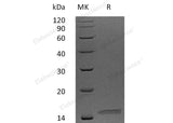 Recombinant Human Neurturin/NRTN Protein