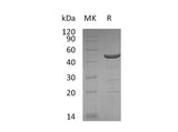 Recombinant Human Neutrophil Cytosol Factor 1/NCF1 Protein (His Tag)