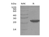 Recombinant Human NGAL/Lipocalin-2 Protein (His Tag, Human Cells)